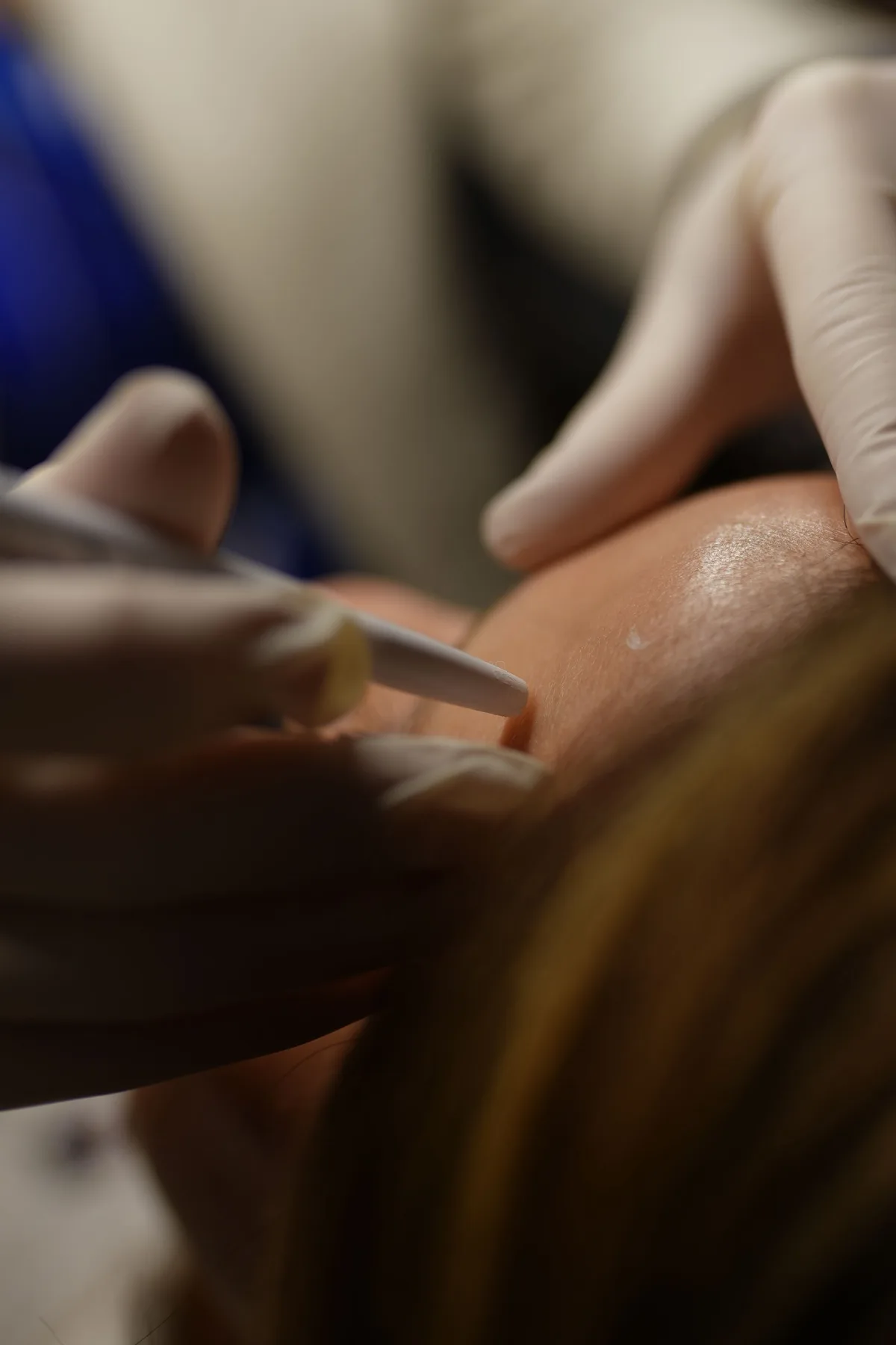 Detalle de un tratamiento en curso en la clínica